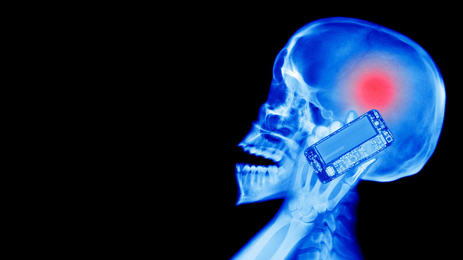 Phonegate : nos telephones emettent des ondes illégales